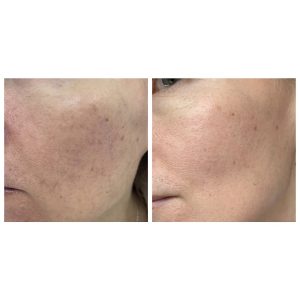 آمپول التیام بخش سنتلا ماداگاسکار اسکین 1004 SKIN1004 Madagascar Centella Ampoule