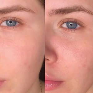 آمپول التیام بخش سنتلا ماداگاسکار اسکین 1004 SKIN1004 Madagascar Centella Ampoule