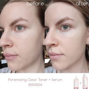 آمپول کنترل و کوچک کننده منافذ سنتلا ماداگاسکار اسکین 1004 Centella Poremizing Fresh Ampoule