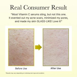 سرم روشن کننده و ضدلک ویتامین سی آرنسیا Arencia Vitamin C حجم 30 میل